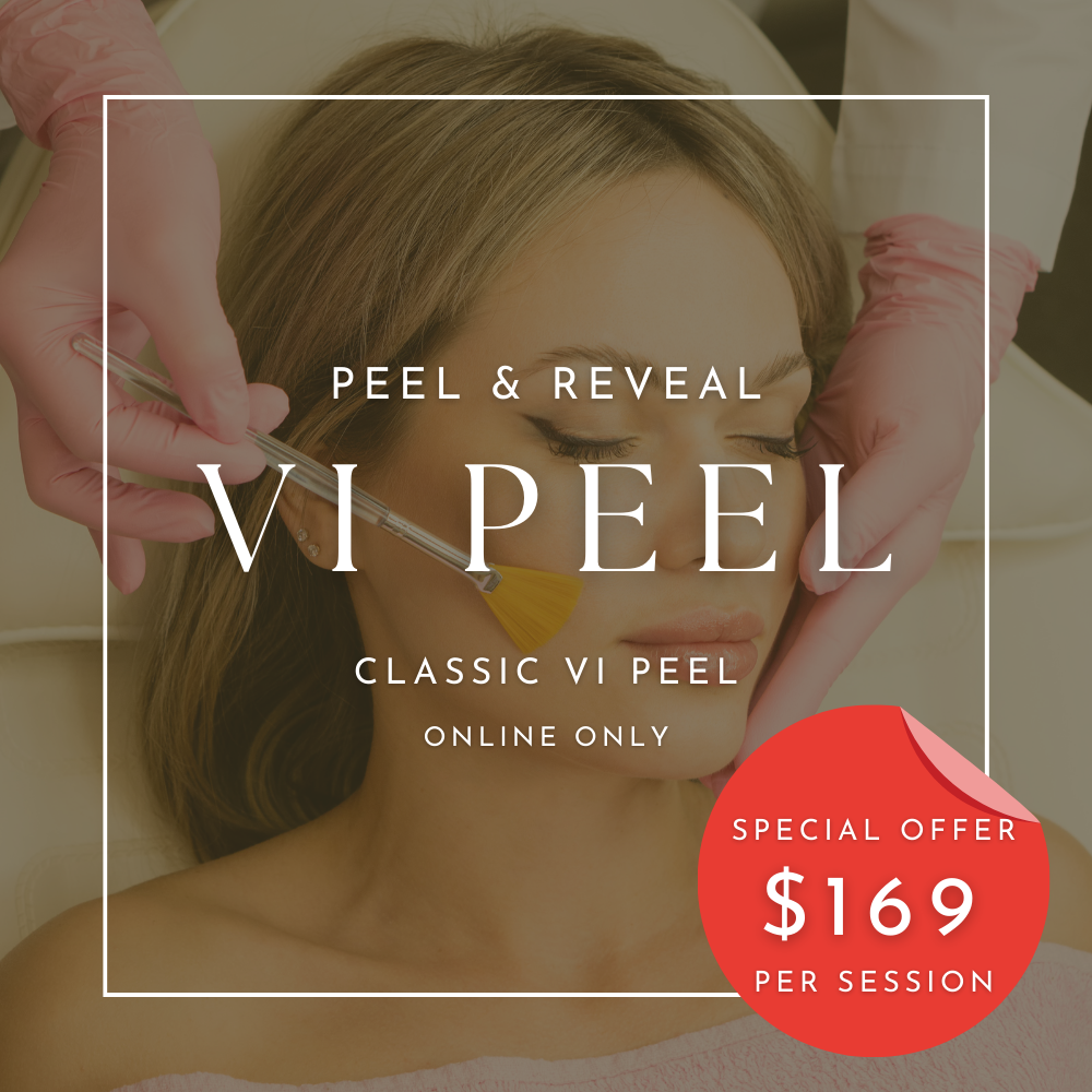 Classic VI Peel